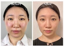 ウンジョルノ フェリーチェ 表参道店/頬もしっかり流していきます