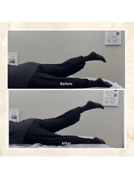 プレメ 人形町院(The Preme)/股関節の伸展 可動域拡大