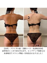 ヨサパーク マーブル 武蔵小山(YOSA PARK MARBLE)/ ブライダル前にダイエット