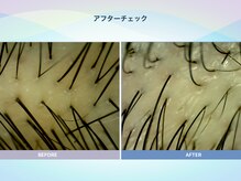 アンス(anth:)/お客様の仕上がり