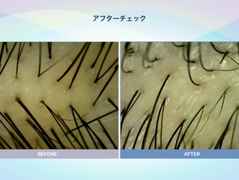 アンス(anth:)/お客様の仕上がり