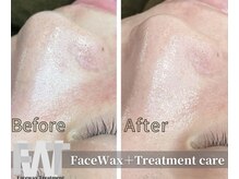 ミロク(MIROKU.)/フェイスワックストリートメント