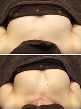 ラディス(Radice.)/バストアップを叶えませんか？