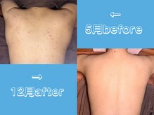 ポラリス(Polaris)/