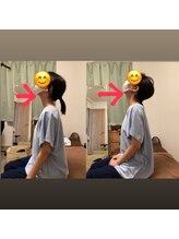 たすき鍼灸治療院/首コリ