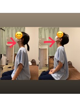 たすき鍼灸治療院/首コリ