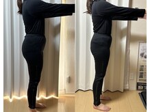 ヨサパーク サン 合志店(YOSAPARK SUN)/ビフォーアフター