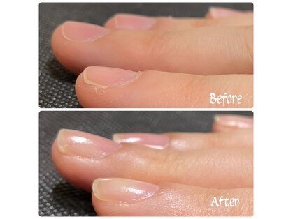 シッカネイル(sicca nail)の写真