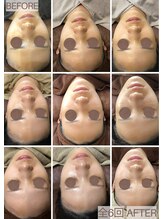 ビーカーブス 三鷹(B.curves)/before・after