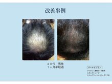 ラ ソワ(la soie)/育毛促進ヘッドスパ　40代男性