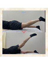 プレメ 人形町院(The Preme)/股関節の伸展　可動域拡大