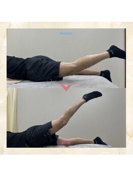 プレメ 人形町院(The Preme)/股関節の伸展 可動域拡大