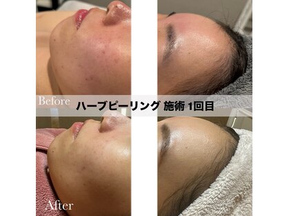 シェリー(SHELLY)の写真