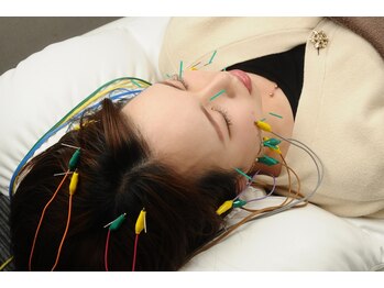 セレーノ(SERENO)/鍼に優しく電気を流していきます