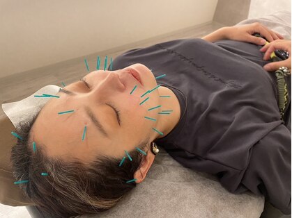 とまり木鍼灸整骨院の写真