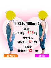 さらさ整骨院/ダイエット整体ビフォーアフター