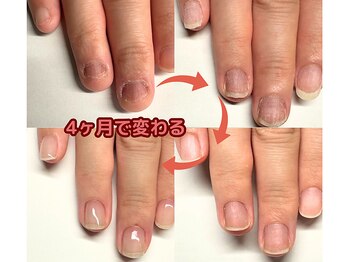 4ヶ月で変わる！