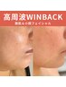 艶肌と小顔が手に入るWINBACKフェイシャル 90分 ¥16,500→¥5,000