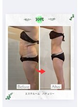 エステルーム パチュリー/脂肪クルスカダブルダブルダブル