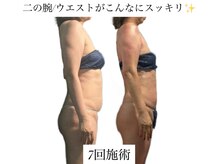 痩身革命 大宮店/筋膜リリース/リンパ/ダイエット