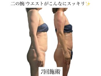 痩身革命 大宮店/筋膜リリース/リンパ/ダイエット