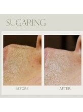 ルブラン(Le blanc)/シュガーリング脱毛♪