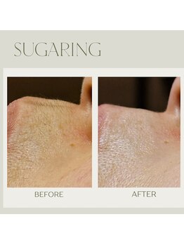 ルブラン(Le blanc)/シュガーリング脱毛♪