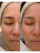 彌庵/タイムロックプログラム　症例