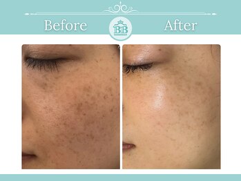 ゼロ美人 那覇店(ZERO美人)/【シミケア☆シミケアZERO美人】