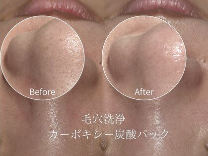 ノエル 久里浜店(Noel)の写真