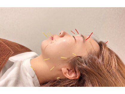 たかさきひかり鍼灸整骨院の写真