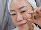 水光ピールスキンの写真/【韓国最先端美容★スーパージェクション】エクソソームヒアルロン酸導入でたるみやほうれい線を徹底ケア◎