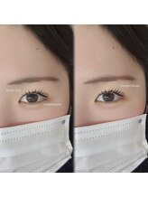 ルーフアイ(ROOF EYE)/ROOF EYE(ルーフ アイ)