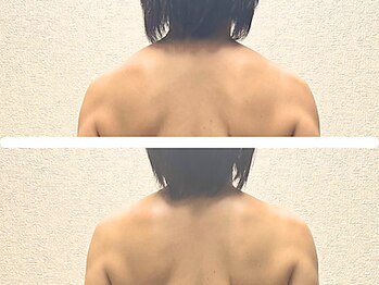 リンド(Lindo)/肩こり・まき肩改善◎