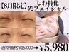 【8月限定】しわ・たるみ改善！光フェイシャル当て放題 ¥15000→