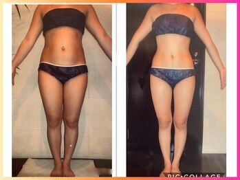 ベリンダ 銀座店(BELINDA)/☆ビフォーアフターのご紹介☆