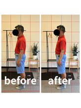 熊本カワル整体 JR上熊本駅院/腰痛と大腰筋の関係