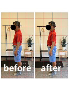 熊本カワル整体 JR上熊本駅院/腰痛と大腰筋の関係