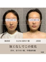 エレーニ 麻布十番(ELENI)/あなたの顔はもっと小さくなれる
