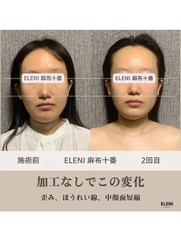 エレーニ 麻布十番(ELENI)/あなたの顔はもっと小さくなれる