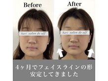 ハリサロンドオフ 心斎橋店(hari salon de off)/4ヵ月継続の結果☆