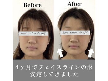 ハリサロンドオフ 心斎橋店(hari salon de off)/4ヵ月継続の結果☆