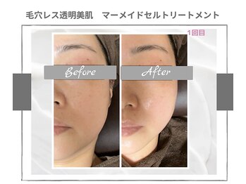 ラ ルーチェ 星田/マーメイドセルトリートメント