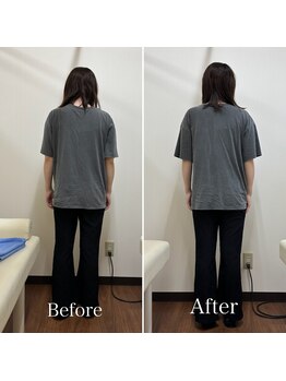 宮町鍼灸整骨院/産後の姿勢や体型の変化にも対応