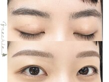 フレックル(freckle)