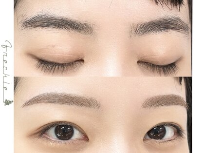 フレックル(freckle)の写真