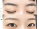 フレックル(freckle)の写真