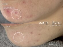 コウル 川西能勢口店(geoul)/毛穴レス美肌コース3回