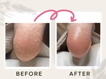 ドクターネイル爪革命 恵庭店/