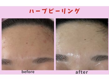 サロン ほほえむ(Fofo-m)/